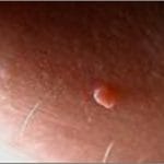 Et Beni Neden Çıkar