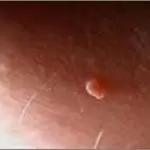Et Beni Neden Çıkar
