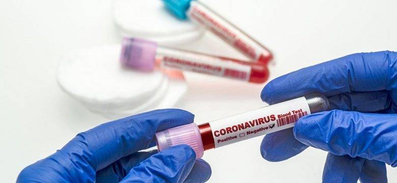 23 Ekim 2021 corona virüs tablosu: 217 can kaybı, 26 bin 217 yeni vaka