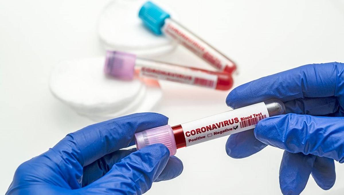 31 Ekim 2021 corona virüs tablosu: 201 can kaybı, 23 bin 948 yeni vaka