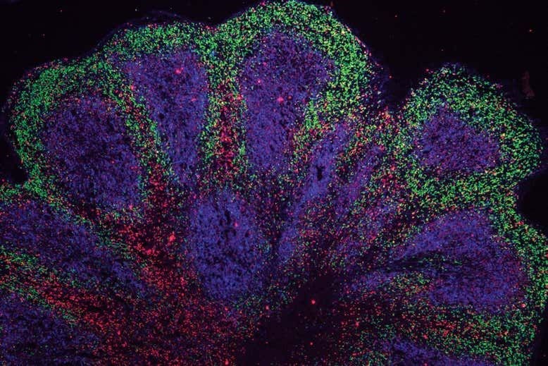 Cambridge Üniversitesi’nden demans ve felce karşı önemli adım: Laboratuvarda mini beyinler geliştirildi