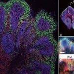 Cambridge Üniversitesi’nden demans ve felce karşı önemli adım: Laboratuvarda mini beyinler geliştirildi