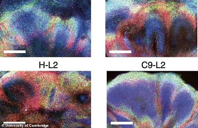 Cambridge Üniversitesi’nden demans ve felce karşı önemli adım: Laboratuvarda mini beyinler geliştirildi