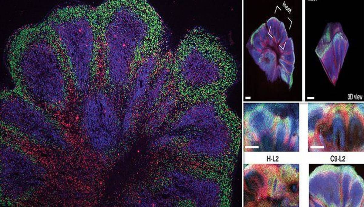 Cambridge Üniversitesi'nden demans ve felce karşı önemli adım: Laboratuvarda mini beyinler geliştirildi