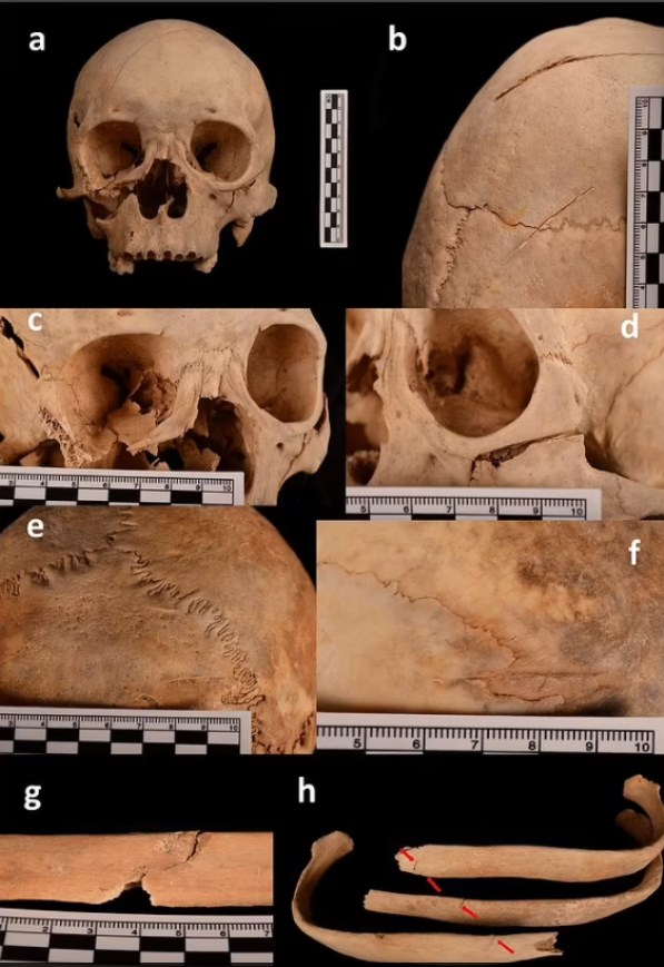dunyanin en eski cinayet vakasi bin 300 yil sonra cozuldu 3