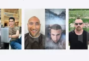 Türkiye Saç Ekimi Fiyatları (Turkey Hair Transplant Cost)