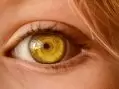 Spiral Nedir? Kadınlara Neden Spiral Takılır?