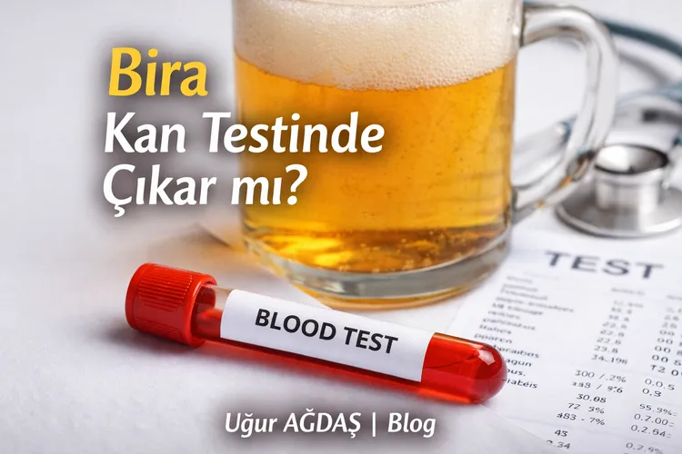 Bira Kan Testinde Çıkar mı?