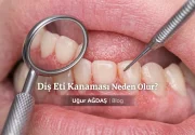 Diş Eti Kanaması Neden Olur?